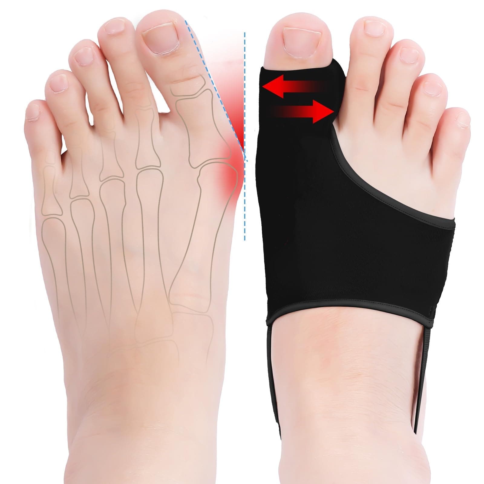QCCL 2PCS Bunion Corrector for Women & Men - Toe Alignment Corrector with Splint & Pads for Hallux Valgus Pain Relief, Comfortable Toe Separator for Day/Night Support, Anti Slip Big Toe Straightener